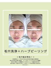 ソワナ(soina)/【神楽坂駅/フェイシャル/毛穴】