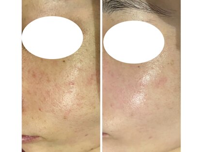 ビューティークリニックコダマ 延岡店の写真