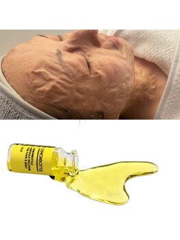 玉響(Tamayura)の写真/ほうれい線・たるみは老け顔の原因に！最新美容レモンボトルやゾンビマスクで美しいフェイスラインに☆