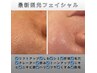 ★4週間以内★【最新光フェイシャル】複数お悩み改善¥19,900→¥14,400 100分