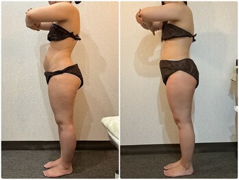 美容整体ウェリナ 中川八田院/小顔矯正/骨盤矯正/美脚サロン