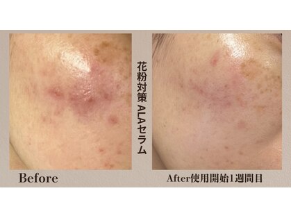 ジェルム(germe.)の写真