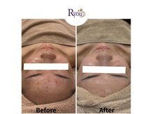 アールユー ギンザ(Ryou ginza)の雰囲気（ボディケア/フェイシャル/肌管理/毛穴）