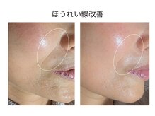 エボルブ 四条烏丸店(EVOLVE)の雰囲気（60代の肌改善にも実績！去年から始めた人は今もう綺麗に♪）