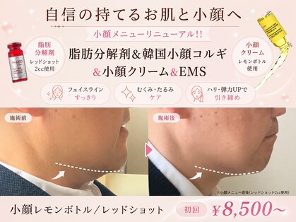 フェリス(feliz)の写真
