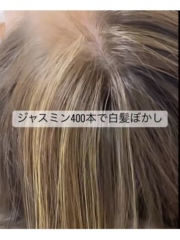 キラン(KIRAN)/装着箇所目立ちません♪