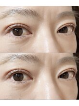 アイラッシュプラン リノ(eyelash plan RINO)/韓国風パーマ