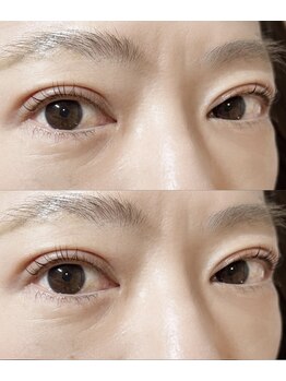 アイラッシュプラン リノ(eyelash plan RINO)/韓国風パーマ