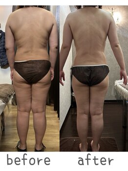 トモズサロン28(Tomos.salon.)/血液循環改善により基礎代謝向上