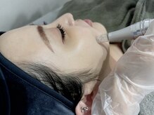 ボニータアンジュ 恵比寿(Bonita Ange)/小顔×たるみ×脂肪分解ケア