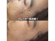 ベリスユイット(BELLIS HUIT)