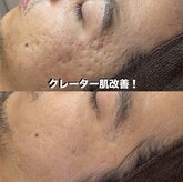 ベリスユイット(BELLIS HUIT)