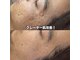 ベリスユイット(BELLIS HUIT)の写真