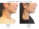 サボラミ(sabor A Mi)の写真