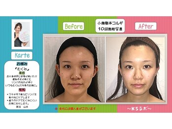 小顔整体研究所 KSラボ 天王寺店/