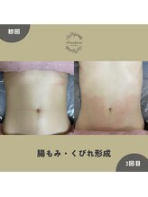 プラス バスト(+Plusバスト)/腸もみ・くびれ形成