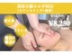 プラセル(PLACER)の写真