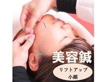 ほねつぎ三輪はりきゅう接骨院/【美容鍼】