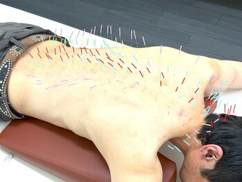 とだ鍼灸院/背骨の際/疲れ/肋骨の締め付け！