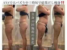 痩身革命 大宮店