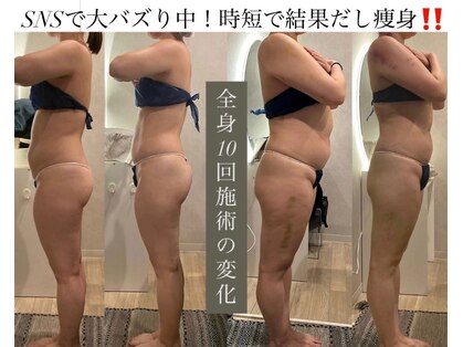 痩身革命 大宮店の写真