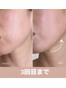 【極まる小顔・むくみ改番】引き締まり＆小顔効果 ¥17600→¥16500