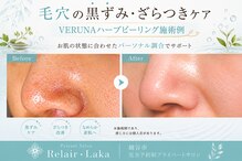 リレア ラカ(Relair Laka)