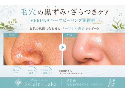 リレア ラカ(Relair Laka)の写真