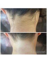 マイレ 銀座(MAILE)/うなじ