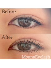 モアナ 逗子 葉山(MOANA)/上下ラッシュリフト