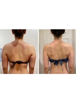 ルナグランデ 心斎橋店(Luna grande.)/痩身と凝りもほぐして姿勢改善