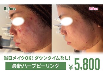 アネル うるま店(anel)