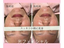 CBDサロン ローズ(ROSE)の雰囲気（小顔作りなら光フェイシャル＋遺伝子コスメ両刀遣いでバッチリ！）
