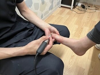 とくしま整体院 藍住院/巻き爪など爪で悩まれている方へ