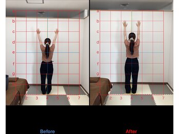 北春日部接骨院/肩　　ビフォーアフター