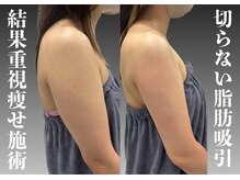 クレビア(CREBIA)の雰囲気（天然成分脂肪分解液を肌深く届ける機器で短期間脂肪集中ケア！）