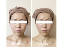 サロンミッシェル(Salon Michel)/