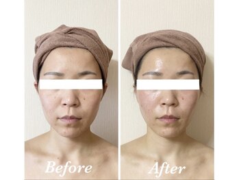 サロンミッシェル(Salon Michel)/