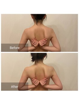 ベンザイ 梅田店(BENZAI)/スマホ首が老け見えの原因