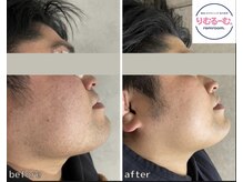 リムルーム 八王子(remroom.)/