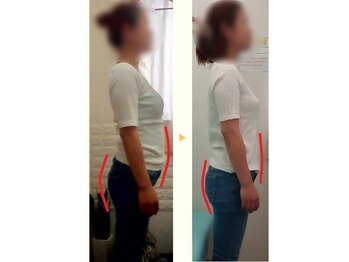 フィール整体院/ぽっこりお腹も改善！