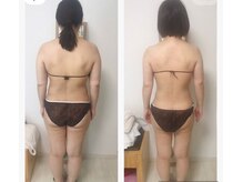ビューティーチャージ(BeautyCharge)の雰囲気(痩身メニューを2週に1回していき驚く変化!食事制限なし)