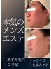 【本気のメンズエステ】毛穴・ニキビ・黒ずみ・たるみケア・リフトアップ