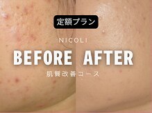 ニコリ(NICOLI)の雰囲気（お悩みや肌の気がかりは何度でも同じ価格定額プランがおすすめ！）
