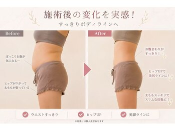 イトウサロン(ITO SALON)/