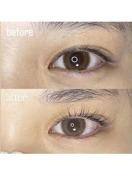 ネイルサロン シャンティ 横浜(Nail Salon Shanti)/ビフォーアフター♪