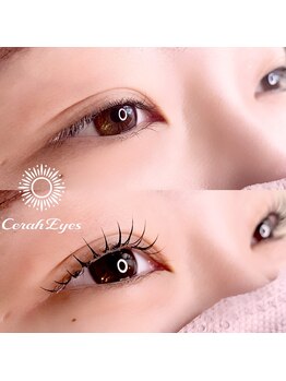 チュラアイズ(CerahEyes)/【お客様ビフォーアフター】