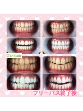 ルブラン 奈良店(Le Blanc)/綺麗な歯はいい印象を受けます！