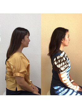 オズ六本木/六本木小顔矯正(造顔)姿勢整う