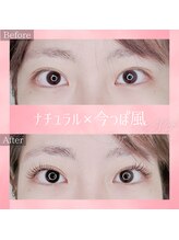 コトリ(kotori)/デザインキープラッシュ